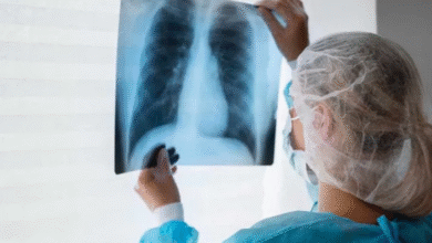 Photo of कमजोर इम्युनिटी और खराब जीवनशैली दे रही टीबी को न्योता