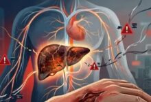 Photo of शरीर का ‘सिस्टम फेल’ कर सकती है लिवर की ये बीमारी